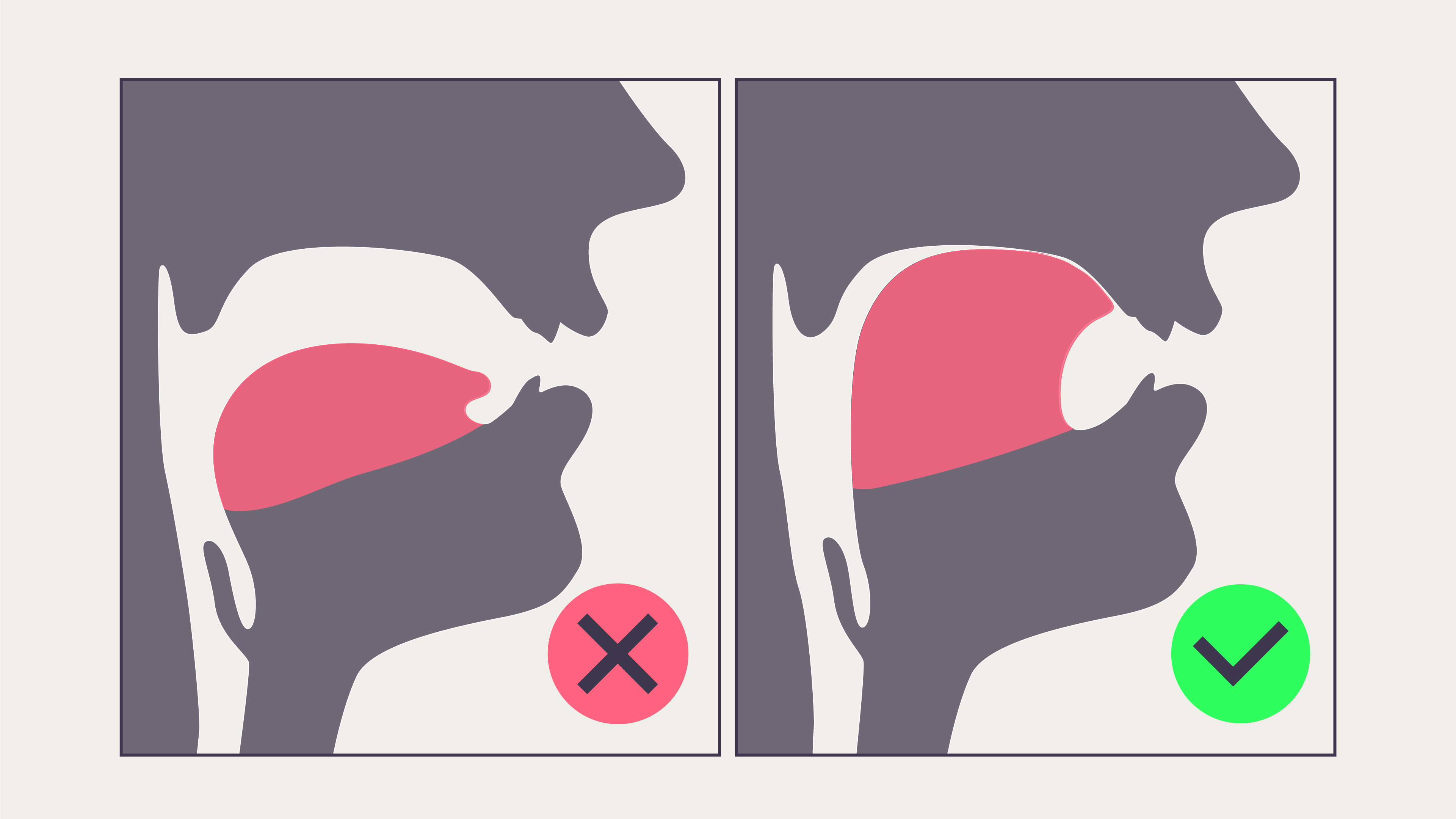 Mewing Tongue Posture Diagram